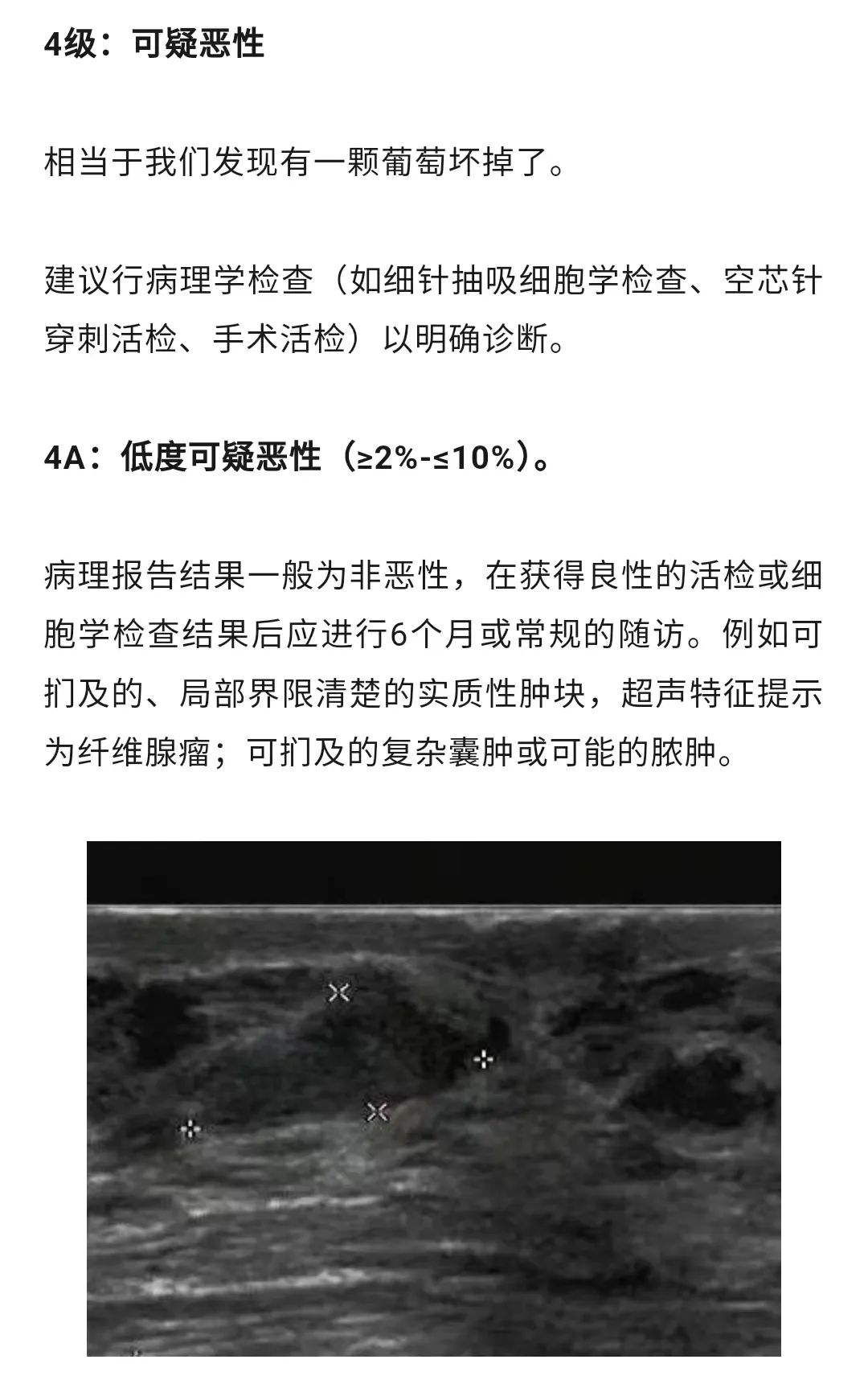 乳腺結(jié)節(jié)惡性的可能性有多大?一文讀懂乳腺結(jié)節(jié)BI-RADS分級(jí)標(biāo)準(zhǔn)!