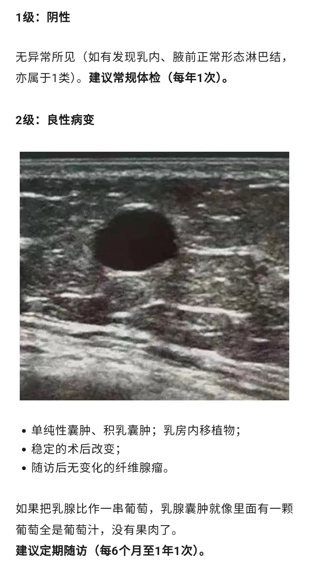 乳腺結(jié)節(jié)惡性的可能性有多大?一文讀懂乳腺結(jié)節(jié)BI-RADS分級(jí)標(biāo)準(zhǔn)!