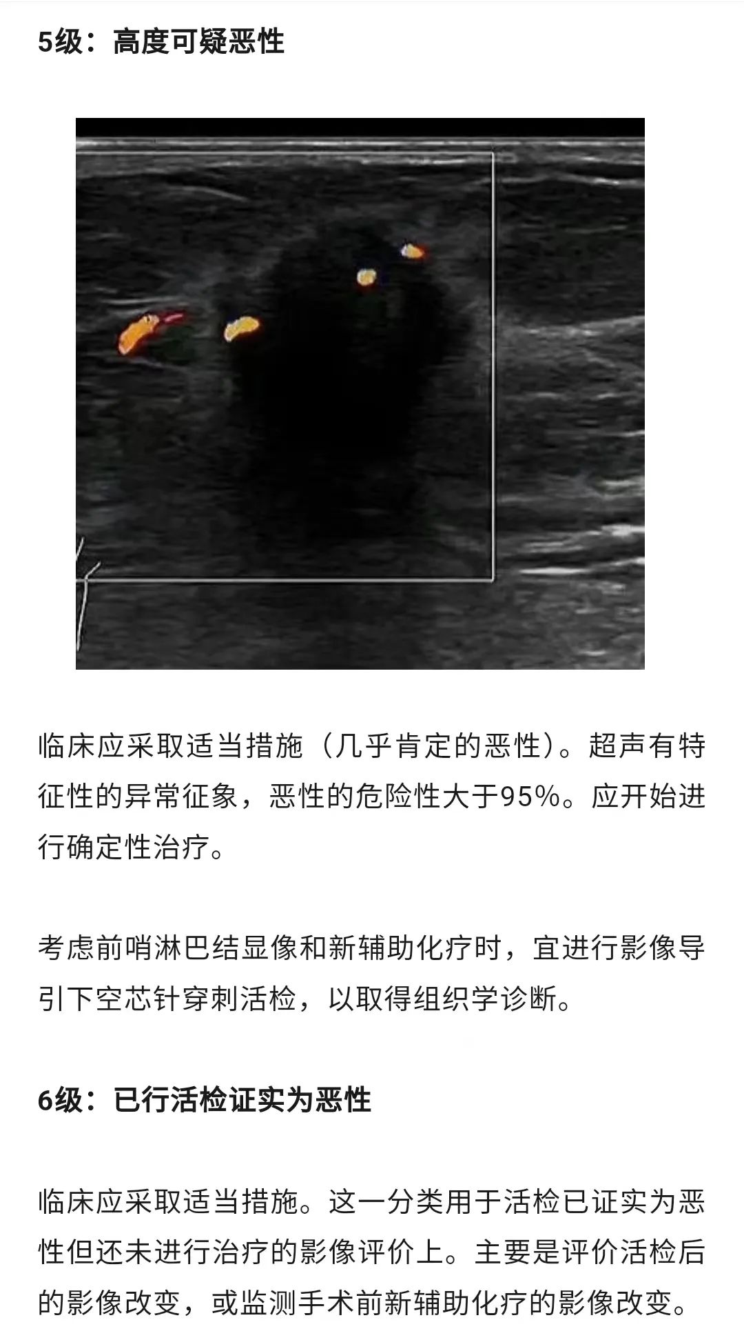 乳腺結(jié)節(jié)惡性的可能性有多大?一文讀懂乳腺結(jié)節(jié)BI-RADS分級(jí)標(biāo)準(zhǔn)!